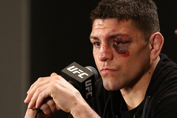 1-nick-diaz