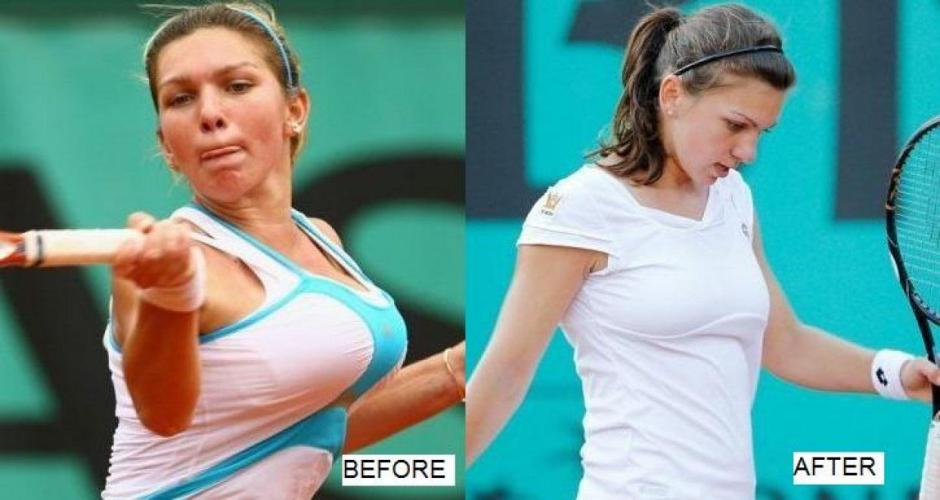 13-simona-halep-before-and-after-before-and-after
